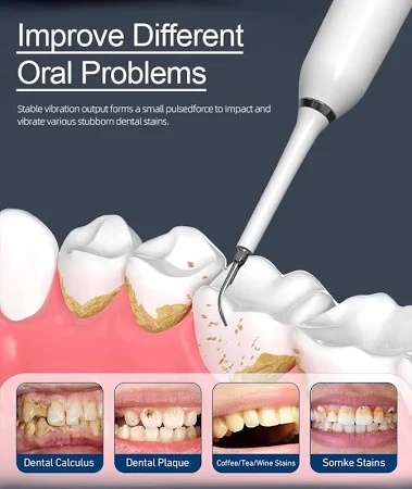 plaque-removal-tool-cleaning-modes